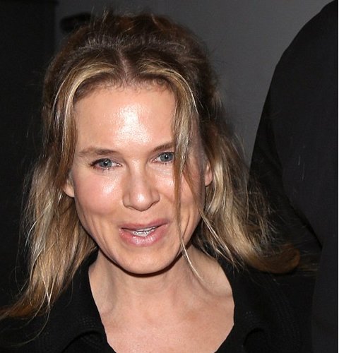 Renee Zellweger Su cambio tras una operación de cirugía estética